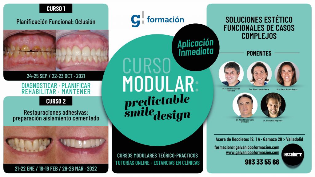 Curso Predictable Smile Design